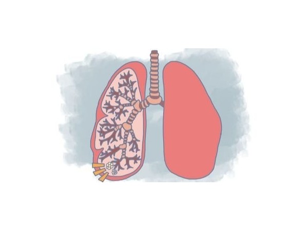 8種果蔬是對抗肺結(jié)節(jié)“法寶”，家里常備，助力恢復(fù)！