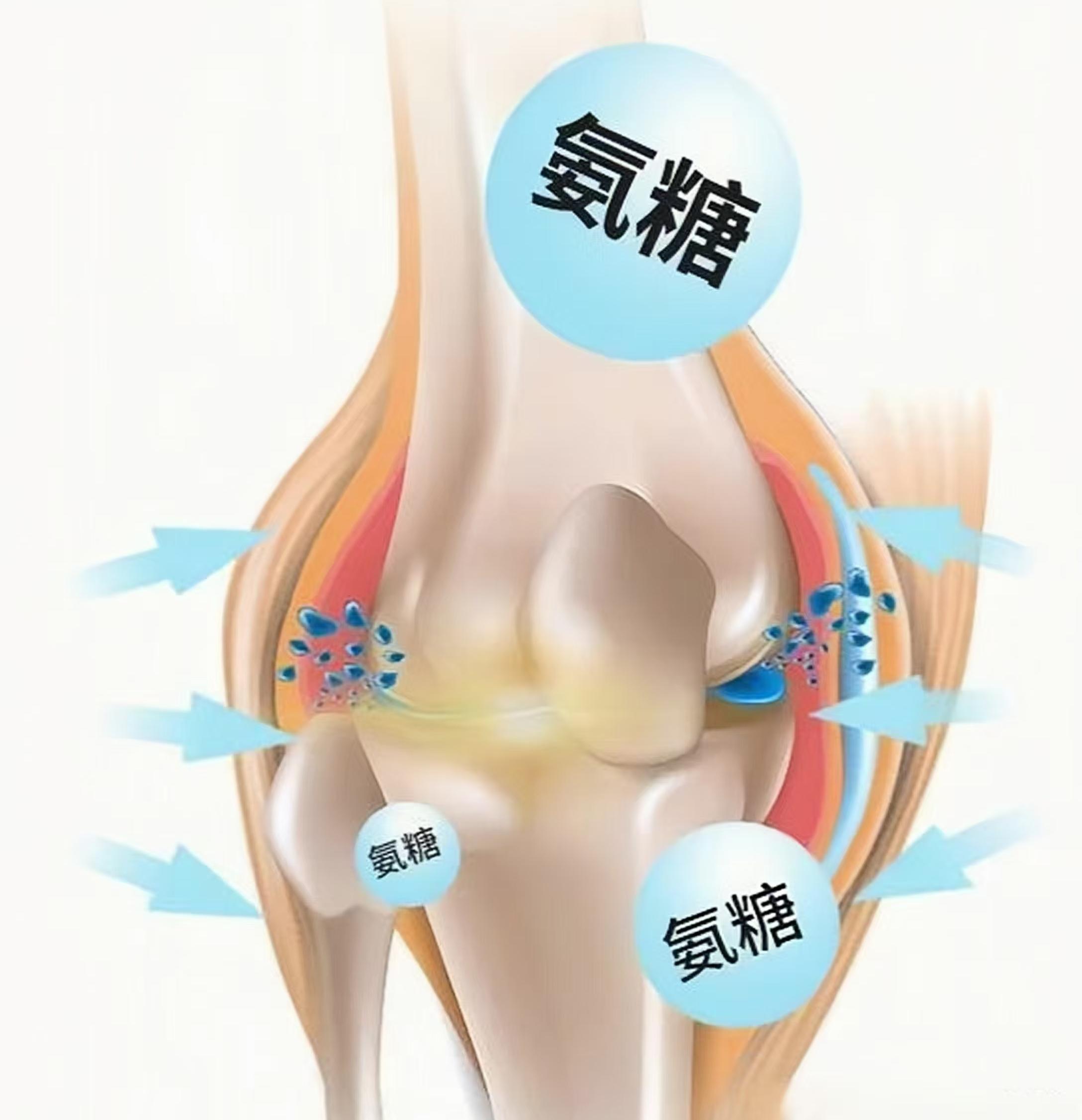 氨糖適合什么樣的人群補(bǔ)充？