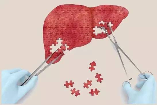 拯救不良肝臟，補充硒元素，真正預(yù)防肝病風險